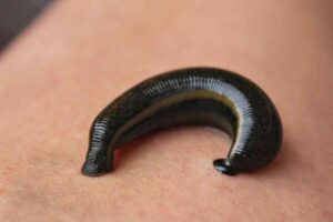 Decode Your Dreams: What Does Dream About Leeches Mean?